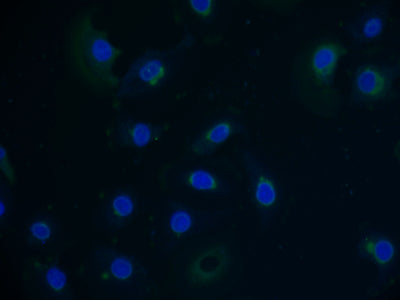 Immunofluorescent analysis of A549 cells using PVRIG Antibody at dilution of 1:100 and Alexa Fluor 488-congugated AffiniPure Goat Anti-Rabbit IgG(H+L)Rabbit anti-Human PVRIG Polyclonal Antibody