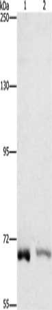 Gel: 6%SDS-PAGE, Lysate: 40 μg, Lane 1-2: K562 cells, A431 cells, Primary antibody: CENPE Antibody(CENPE Antibody) at dilution 1/1400, Secondary antibody: Goat anti rabbit IgG at 1/8000 dilution, Exposure time: 1 minuteRabbit anti-Human CENPE Polyclonal Antibody