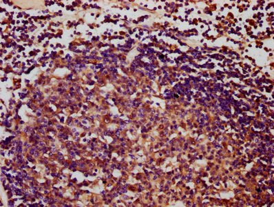 IHC image of IBA57 Antibody diluted at 1:400 and staining in paraffin-embedded human lymph node tissue performed on a Leica BondTM system. After dewaxing and hydration, antigen retrieval was mediated by high pressure in a citrate buffer (pH 6.0). Section was blocked with 10% normal goat serum 30min at RT. Then primary antibody (1% BSA) was incubated at 4°C overnight. The primary is detected by a biotinylated secondary antibody and visualized using an HRP conjugated SP system.