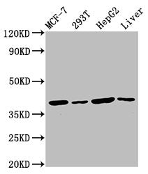 Western Blot  | Positive WB detected in: MCF-7 whole cell lysate, 293T whole cell lysate, HepG2 whole cell lysate, Mouse liver tissue  | All lanes: IBA57 antibody at 4.5µg/ml  | Secondary  | Goat polyclonal to rabbit IgG at 1/50000 dilution  | Predicted band size: 39 kDa  | Observed band size: 39 kDa