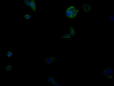 Immunofluorescence staining of PC-3 cells with GPRC6A Antibody at 1:100, counter- stained with DAPI. The cells were fixed in 4% formaldehyde, permeabilized using 0.2% Triton X-100 and blocked in 10% normal Goat Serum. The cells were then incubated with the antibody overnight at 4°C. The secondary antibody was Alexa Fluor 488-congugated AffiniPure Goat Anti-Rabbit IgG(H+L).Rabbit anti-Human GPRC6A Polyclonal Antibody