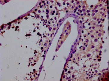 IHC image of GPRC6A Antibody diluted at 1:50 and staining in paraffin-embedded human testis tissue performed on a Leica BondTM system. After dewaxing and hydration, antigen retrieval was mediated by high pressure in a citrate buffer (pH 6.0). Section was blocked with 10% normal goat serum 30min at RT. Then primary antibody (1% BSA) was incubated at 4°C overnight. The primary is detected by a biotinylated secondary antibody and visualized using an HRP conjugated SP system.Rabbit anti-Human GPRC6A Polyclonal Antibody