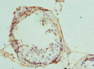 Immunohistochemistry of paraffin-embedded human testis tissue using INTS11 Antibody at dilution of 1:100