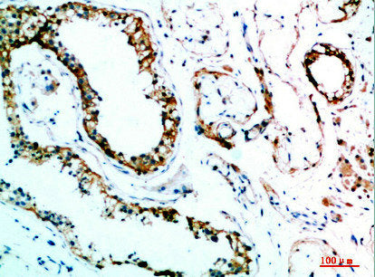 Immunohistochemical analysis of paraffin-embedded human-testis, antibody was diluted at 1:200Rabbit anti-Human IL31 Polyclonal Antibody
