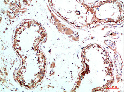 Immunohistochemical analysis of paraffin-embedded human-testis, antibody was diluted at 1:200Rabbit anti-Human IL31 Polyclonal Antibody