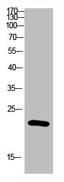 Western blot analysis of Hela Cell Lysate using antibody. Secondary antibody  was diluted at 1:20000Rabbit anti-Human IL31 Polyclonal Antibody