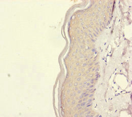 Immunohistochemistry of paraffin-embedded human skin tissue using REEP5 Antibody at dilution of 1:100Rabbit anti-Human REEP5 Polyclonal Antibody