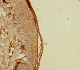 Immunohistochemistry of paraffin-embedded human skin tissue using REEP5 Antibody at dilution of 1:100Rabbit anti-Human REEP5 Polyclonal Antibody