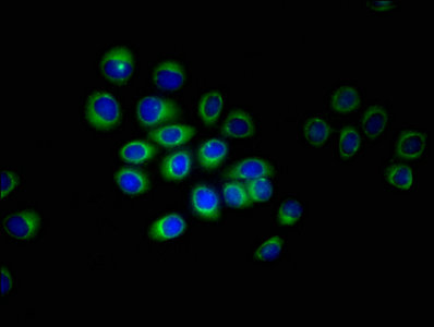 Immunofluorescent analysis of A549 cells using ERVK-6 Antibody at dilution of 1:100 and Alexa Fluor 488-congugated AffiniPure Goat Anti-Rabbit IgG(H+L)Rabbit anti-Human ERVK-6 Polyclonal Antibody