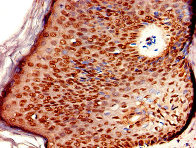 Immunohistochemistry of paraffin-embedded human skin tissue using the antibody at dilution of 1:100Rabbit anti-Human ERVK-6 Polyclonal Antibody