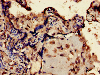 Immunohistochemistry of paraffin-embedded human placenta tissue using ERVK-6 Antibody at dilution of 1:100Rabbit anti-Human ERVK-6 Polyclonal Antibody