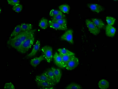 Immunofluorescence staining of HepG2 cells with ODR4 Antibody at 1:133, counter-stained with DAPI. The cells were fixed in 4% formaldehyde, permeabilized using 0.2% Triton X-100 and blocked in 10% normal Goat Serum. The cells were then incubated with the antibody overnight at 4°C. The secondary antibody was Alexa Fluor 488-congugated AffiniPure Goat Anti-Rabbit IgG(H+L).Rabbit anti-Human ODR4 Polyclonal Antibody
