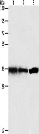Gel: 15%SDS-PAGE, Lysate: 40 μg, Lane 1-3: Hela cells, 293T cells, 231 cells, Primary antibody: GNB1 Antibody(GNB1 Antibody) at dilution 1/450, Secondary antibody: Goat anti rabbit IgG at 1/8000 dilution, Exposure time: 1 secondRabbit anti-Human GNB1 Polyclonal Antibody