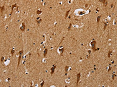 The image on the left is immunohistochemistry of paraffin-embedded Human brain  tissue using NDUFS3 Antibody(NDUFS3 Antibody) at dilution 1/40, on the right is treated with fusion protein. (Original magnification: ×200)Rabbit anti-Human NDUFS3 Polyclonal Antibody