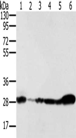 Gel: 8%SDS-PAGE, Lysate: 40 μg, Lane 1-6: 293T cells, NIH/3T3 cells, Raw264.7 cells, hela cells, human fetal brain  tissue, mouse brain tissue, Primary antibody: NDUFS3 Antibody(NDUFS3 Antibody) at dilution 1/350, Secondary antibody: Goat anti rabbit IgG at 1/8000 dilution, Exposure time: 5 secondsRabbit anti-Human NDUFS3 Polyclonal Antibody