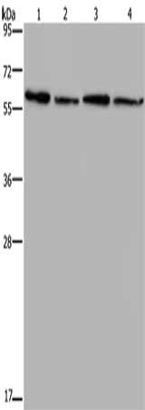 Gel: 10%SDS-PAGE, Lysate: 40 μg, Lane 1-4: Mouse kidney tissue, Mouse liver tissue, Mouse heart tissue, Mouse brain tissue, Primary antibody: ART4 Antibody(ART4 Antibody) at dilution 1/667, Secondary antibody: Goat anti rabbit IgG at 1/8000 dilution, Exposure time: 2 minutesRabbit anti-Human ART4 Polyclonal Antibody