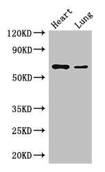 Western Blot | Positive WB detected in: Mouse heart tissue, Mouse lung tissue | All lanes: DCAF8 antibody at 3.5μg/ml | Secondary | Goat polyclonal to rabbit IgG at 1/50000 dilution | Predicted band size: 67, 31 kDa | Observed band size: 67 kDaRabbit anti-Human DCAF8 Polyclonal Antibody