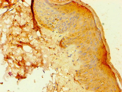 Immunohistochemistry of paraffin-embedded human skin tissue using ANXA8L1 Antibody at dilution of 1:100Rabbit anti-Human ANXA8L1 Polyclonal Antibody