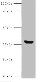 Western blot | All lanes: ANXA8L2 antibody at 18μg/ml + HepG2 whole cell lysate | Secondary | Goat polyclonal to rabbit IgG at 1/10000 dilution | Predicted band size: 37, 31 kDa | Observed band size: 37 kDaRabbit anti-Human ANXA8L1 Polyclonal Antibody