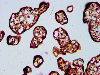 IHC image of SOS1 Antibody diluted at 1:400 and staining in paraffin-embedded human placenta tissue performed on a Leica BondTM system. After dewaxing and hydration, antigen retrieval was mediated by high pressure in a citrate buffer (pH 6.0). Section was blocked with 10% normal goat serum 30min at RT. Then primary antibody (1% BSA) was incubated at 4°C overnight. The primary is detected by a biotinylated secondary antibody and visualized using an HRP conjugated SP system.Rabbit anti-Human SOS1 Polyclonal Antibody