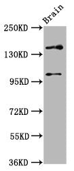 Western Blot | Positive WB detected in: Rat brain tissue | All lanes: SOS1 antibody at 4.6μg/ml | Secondary | Goat polyclonal to rabbit IgG at 1/50000 dilution | Predicted band size: 153, 37 kDa | Observed band size: 153 kDaRabbit anti-Human SOS1 Polyclonal Antibody