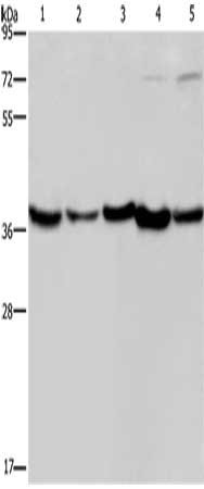 Gel: 8%SDS-PAGE, Lysate: 40 μg, Lane 1-5: Human fetal liver tissue, mouse skeletal muscle tissue, Mouse heart tissue, Hela cells, Jurkat cells, Primary antibody: DNAJB4 Antibody(DNAJB4 Antibody) at dilution 1/200, Secondary antibody: Goat anti rabbit IgG at 1/8000 dilution, Exposure time: 15 secondsRabbit anti-Human DNAJB4 Polyclonal Antibody