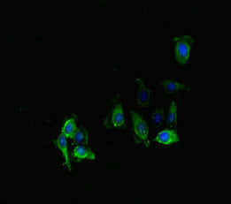 Immunofluorescent analysis of Hela cells using PPP2R2D Antibody at dilution of 1:100 and Alexa Fluor 488-congugated AffiniPure Goat Anti-Rabbit IgG(H+L)Rabbit anti-Human PPP2R2D Polyclonal Antibody