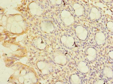 Immunohistochemistry of paraffin-embedded human colon tissue using CWF19L1 Antibody at dilution of 1:100Rabbit anti-Human CWF19L1 Polyclonal Antibody