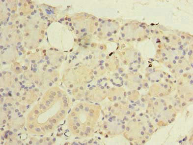 Immunohistochemistry of paraffin-embedded human pancreatic tissue using CWF19L1 Antibody at dilution of 1:100Rabbit anti-Human CWF19L1 Polyclonal Antibody