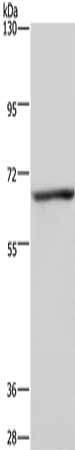 Gel: 6%SDS-PAGE, Lysate: 40 μg, Lane: Human fetal liver tissue, Primary antibody: KCND1 Antibody(KCND1 Antibody) at dilution 1/300, Secondary antibody: Goat anti rabbit IgG at 1/8000 dilution, Exposure time: 5 seconds