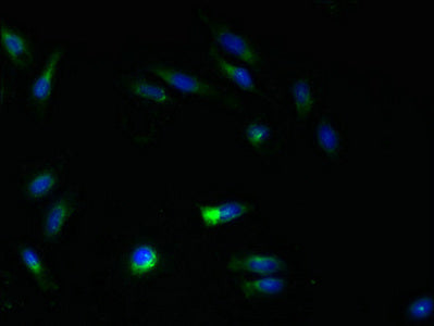 Immunofluorescent analysis of Hela cells using ATL3 Antibody at dilution of 1:100 and Alexa Fluor 488-congugated AffiniPure Goat Anti-Rabbit IgG(H+L)