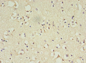 Immunohistochemistry of paraffin-embedded human brain tissue using ATL3 Antibody at dilution of 1:100