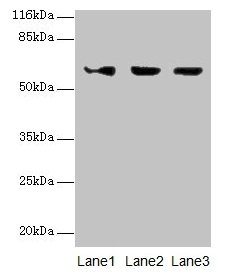 Western blot  | All lanes: ATL3 antibody at 2µg/ml  | Lane 1: Jurkat whole cell lysate  | Lane 2: Hela whole cell lysate  | Lane 3: HepG2 whole cell lysate  | Secondary  | Goat polyclonal to rabbit IgG at 1/10000 dilution  | Predicted band size: 61 kDa  | Observed band size: 61 kDa