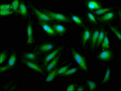 Immunofluorescence staining of Hela cells with UMPS Antibody at 1:33, counter-stained with DAPI. The cells were fixed in 4% formaldehyde, permeabilized using 0.2% Triton X-100 and blocked in 10% normal Goat Serum. The cells were then incubated with the antibody overnight at 4°C. The secondary antibody was Alexa Fluor 488-congugated AffiniPure Goat Anti-Rabbit IgG(H+L).Rabbit anti-Human UMPS Polyclonal Antibody