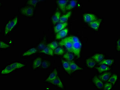 Immunofluorescence staining of Hela cells with OBSCN Antibody at 1:33, counter-stained with DAPI. The cells were fixed in 4% formaldehyde, permeabilized using 0.2% Triton X-100 and blocked in 10% normal Goat Serum. The cells were then incubated with the antibody overnight at 4°C. The secondary antibody was Alexa Fluor 488-congugated AffiniPure Goat Anti-Rabbit IgG(H+L).Rabbit anti-Human OBSCN Polyclonal Antibody