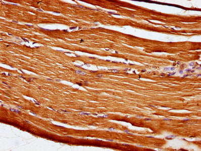 IHC image of the antibody diluted at 1:100 and staining in paraffin-embedded human skeletal muscle tissue performed on a Leica BondTM system. After dewaxing and hydration, antigen retrieval was mediated by high pressure in a citrate buffer (pH 6.0). Section was blocked with 10% normal goat serum 30min at RT. Then primary antibody (1% BSA) was incubated at 4°C overnight. The primary is detected by a biotinylated secondary antibody and visualized using an HRP conjugated SP system.Rabbit anti-Human OBSCN Polyclonal Antibody