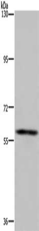 Gel: 6%SDS-PAGE, Lysate: 40 μg, Lane: Human fetal brain tissue, Primary antibody: FTO Antibody(FTO Antibody) at dilution 1/650, Secondary antibody: Goat anti rabbit IgG at 1/8000 dilution, Exposure time: 5 minutesRabbit anti-Human FTO Polyclonal Antibody