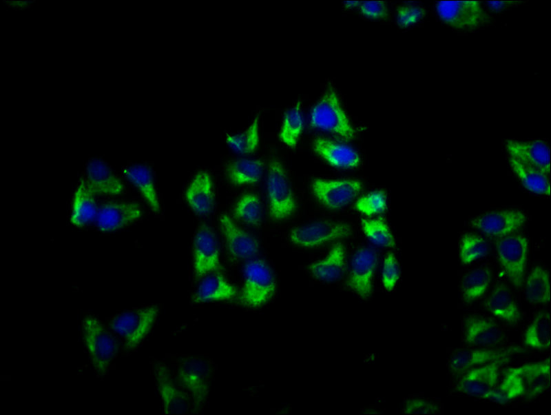 Immunofluorescence staining of Hela cells with BROX Antibody at 1:66, counter-stained with DAPI. The cells were fixed in 4% formaldehyde, permeabilized using 0.2% Triton X-100 and blocked in 10% normal Goat Serum. The cells were then incubated with the antibody overnight at 4°C. The secondary antibody was Alexa Fluor 488-congugated AffiniPure Goat Anti-Rabbit IgG(H+L).