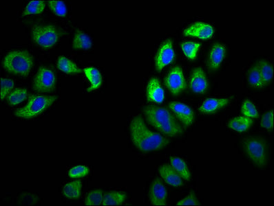 Immunofluorescence staining of Hela cells with SLC6A19 Antibody at 1:100, counter-stained with DAPI. The cells were fixed in 4% formaldehyde, permeabilized using 0.2% Triton X-100 and blocked in 10% normal Goat Serum. The cells were then incubated with the antibody overnight at 4°C. The secondary antibody was Alexa Fluor 488-congugated AffiniPure Goat Anti-Rabbit IgG(H+L).Rabbit anti-Human SLC6A19 Polyclonal Antibody