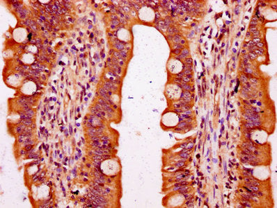IHC image of the antibody diluted at 1:300 and staining in paraffin-embedded human small intestine tissue performed on a Leica BondTM system. After dewaxing and hydration, antigen retrieval was mediated by high pressure in a citrate buffer (pH 6.0). Section was blocked with 10% normal goat serum 30min at RT. Then primary antibody (1% BSA) was incubated at 4°C overnight. The primary is detected by a biotinylated secondary antibody and visualized using an HRP conjugated SP system.Rabbit anti-Human SLC6A19 Polyclonal Antibody