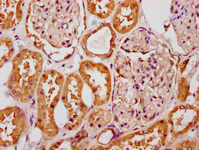 IHC image of SLC6A19 Antibody diluted at 1:300 and staining in paraffin-embedded human kidney tissue performed on a Leica BondTM system. After dewaxing and hydration, antigen retrieval was mediated by high pressure in a citrate buffer (pH 6.0). Section was blocked with 10% normal goat serum 30min at RT. Then primary antibody (1% BSA) was incubated at 4°C overnight. The primary is detected by a biotinylated secondary antibody and visualized using an HRP conjugated SP system.Rabbit anti-Human SLC6A19 Polyclonal Antibody