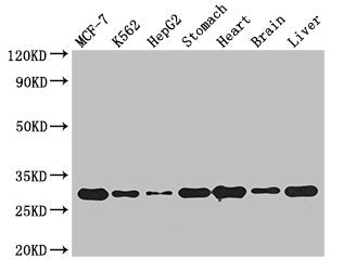 Western Blot | Positive WB detected in: MCF-7 whole cell lysate, K562 whole cell lysate, HepG2 whole cell lysate, Mouse stomach tissue, Mouse heart tissue, Mouse brain tissue, Mouse liver tissue | All lanes: RABGAP1L antibody at 3μg/ml | Secondary | Goat polyclonal to rabbit IgG at 1/50000 dilution | Predicted band size: 30, 93, 69, 95, 91, 44, 42, 43, 9 kDa | Observed band size: 30 kDaRabbit anti-Human RABGAP1L Polyclonal Antibody