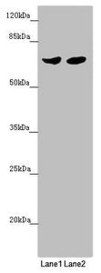 Western blot | All lanes: RARS2 antibody at 2.68 μg/ml | Lane 1: Mouse kidney tissue | Lane 2: HL60 whole cell lysate | Secondary | Goat polyclonal to rabbit IgG at 1/10000 dilution | Predicted band size: 66 kDa | Observed band size: 66 kDaRabbit anti-Human RARS2 Polyclonal Antibody