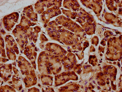 IHC image of the antibody diluted at 1:400 and staining in paraffin-embedded human pancreatic cancer performed on a Leica BondTM system. After dewaxing and hydration, antigen retrieval was mediated by high pressure in a citrate buffer (pH 6.0). Section was blocked with 10% normal goat serum 30min at RT. Then primary antibody (1% BSA) was incubated at 4°C overnight. The primary is detected by a biotinylated secondary antibody and visualized using an HRP conjugated SP system.Rabbit anti-Human SIRPB1 Polyclonal Antibody