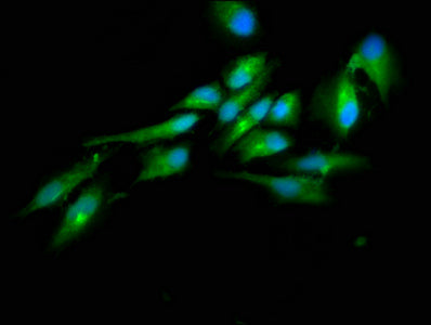 Immunofluorescence staining of Hela cells with HECTD2 Antibody at 1:100, counter-stained with DAPI. The cells were fixed in 4% formaldehyde, permeabilized using 0.2% Triton X-100 and blocked in 10% normal Goat Serum. The cells were then incubated with the antibody overnight at 4°C. The secondary antibody was Alexa Fluor 488-congugated AffiniPure Goat Anti-Rabbit IgG(H+L).Rabbit anti-Human HECTD2 Polyclonal Antibody