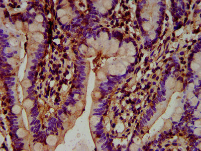 IHC image of HECTD2 Antibody diluted at 1:300 and staining in paraffin-embedded human small intestine tissue performed on a Leica BondTM system. After dewaxing and hydration, antigen retrieval was mediated by high pressure in a citrate buffer (pH 6.0). Section was blocked with 10% normal goat serum 30min at RT. Then primary antibody (1% BSA) was incubated at 4°C overnight. The primary is detected by a biotinylated secondary antibody and visualized using an HRP conjugated SP system.Rabbit anti-Human HECTD2 Polyclonal Antibody