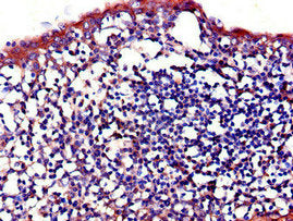Immunohistochemistry of paraffin-embedded human tonsil tissue using IL23R Antibody at dilution of 1:100Rabbit anti-Human IL23R Polyclonal Antibody