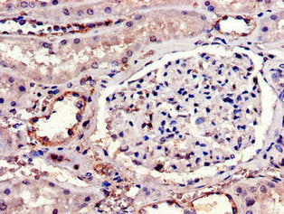 Immunohistochemistry of paraffin-embedded human kidney tissue using IL23R Antibody at dilution of 1:100Rabbit anti-Human IL23R Polyclonal Antibody