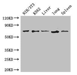 Western Blot | Positive WB detected in: NIH/3T3 whole cell lysate, K562 whole cell lysate, Mouse liver tissue, Mouse lung tissue, Mouse spleen tissue | All lanes: IL23R antibody at 3.4μg/ml | Secondary | Goat polyclonal to rabbit IgG at 1/50000 dilution | Predicted band size: 72, 43, 41, 21, 31, 26 kDa | Observed band size: 72 kDaRabbit anti-Human IL23R Polyclonal Antibody