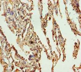 Immunohistochemistry of paraffin-embedded human lung tissue using SLC34A1 Antibody at dilution of 1:100Rabbit anti-Human SLC34A1 Polyclonal Antibody